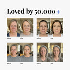 Reverse-aging Adaptive Foundation