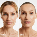 Reverse-aging Adaptive Foundation