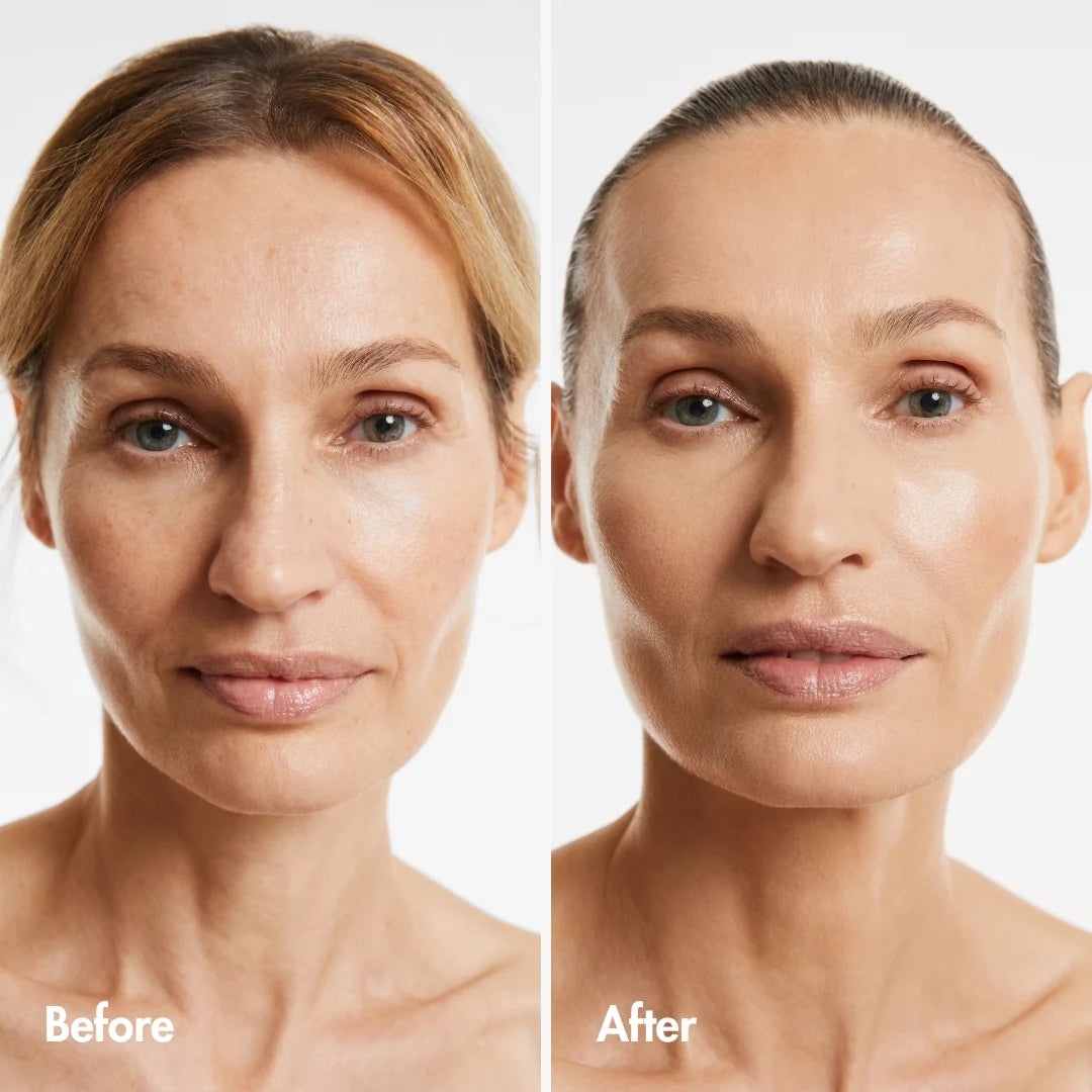 Reverse-aging Adaptive Foundation